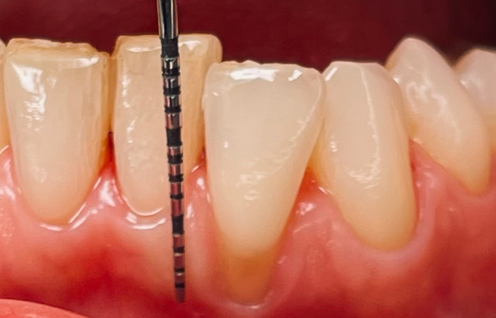 Gmtm - Odontoiatria Specialistica | Parodontologia Milano
