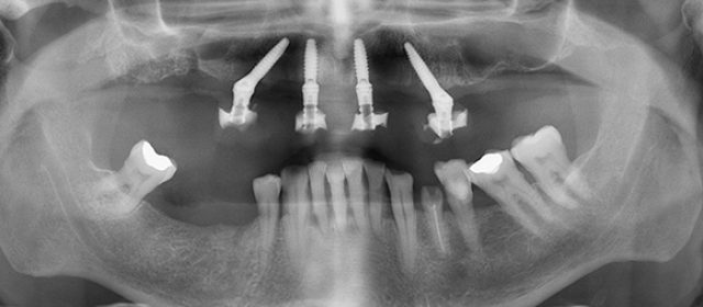 implanotologia-milano-2