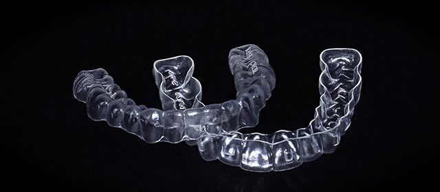 servizi-ortodonzia-trasparente